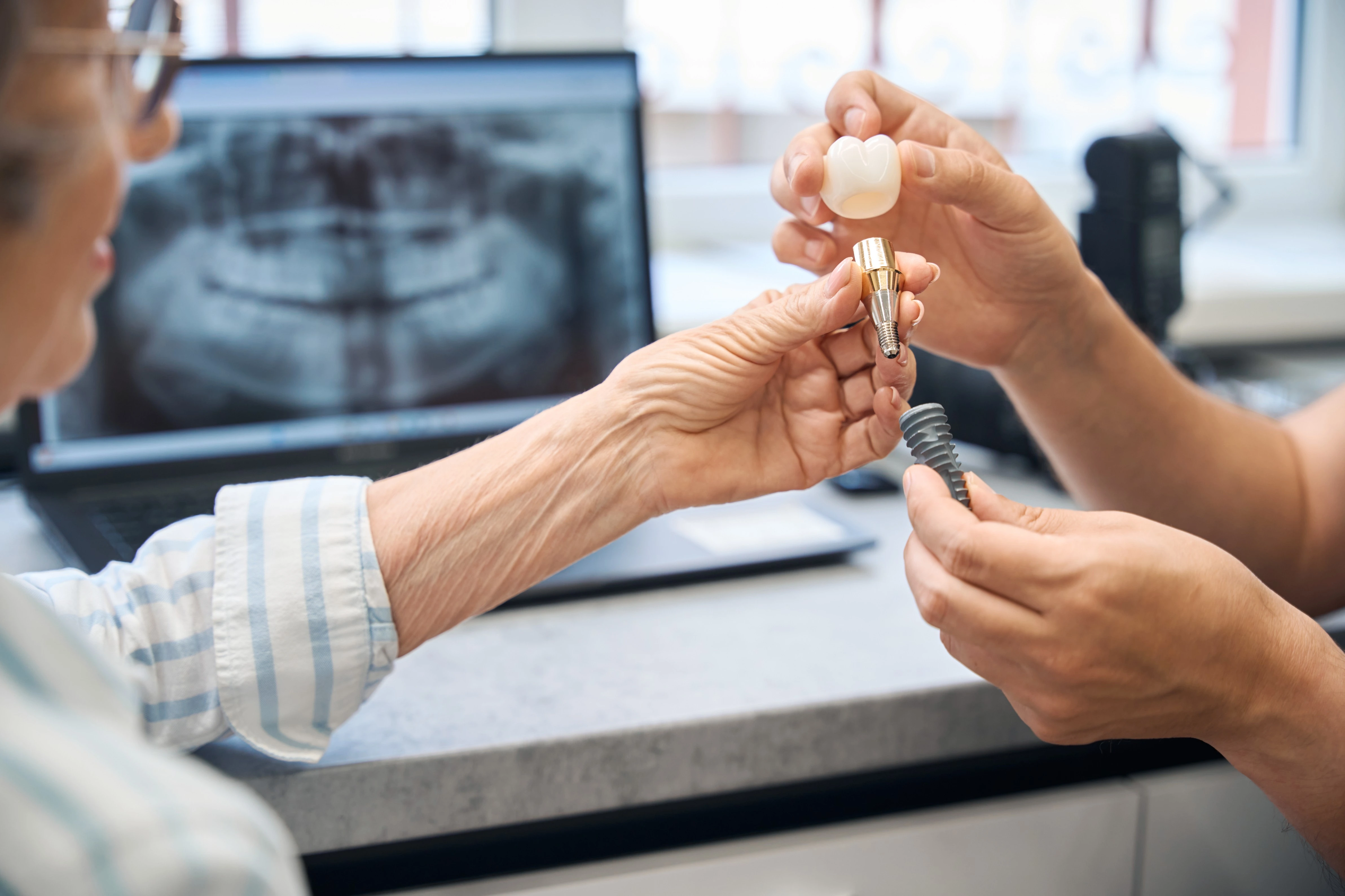 Dental Implant Consultation